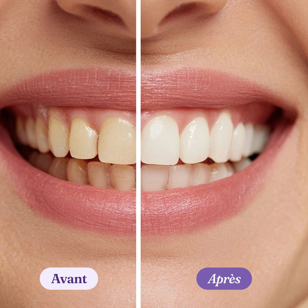 Pastilles de dentifrice solide à croquer blanchissantes MYLILAS